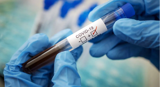 У Полтавській області за тиждень від COVID-19 померли троє людей